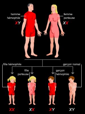 Transmission de l'hémophilie