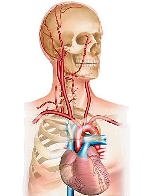 Artères carotides