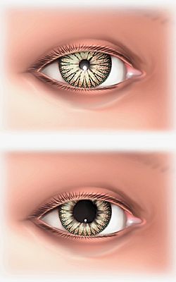 Pupille