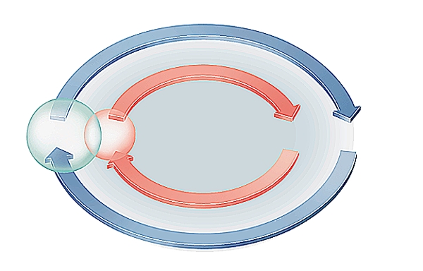 Téniase