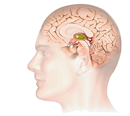 Localisation du thalamus