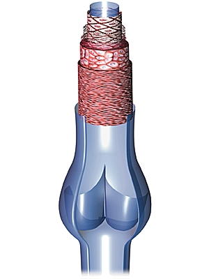 Structure d'une veine Structure d'une veine
